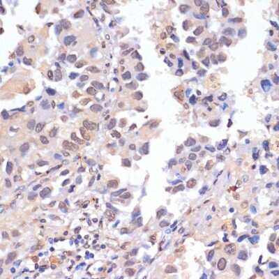 Immunohistochemistry-Paraffin: PIDD Antibody - BSA Free [NBP3-03535]