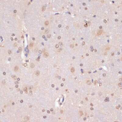 Immunohistochemistry-Paraffin: PIDD Antibody - BSA Free [NBP3-03535]