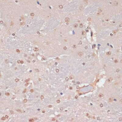 Immunohistochemistry-Paraffin: PIDD Antibody - BSA Free [NBP3-03535]