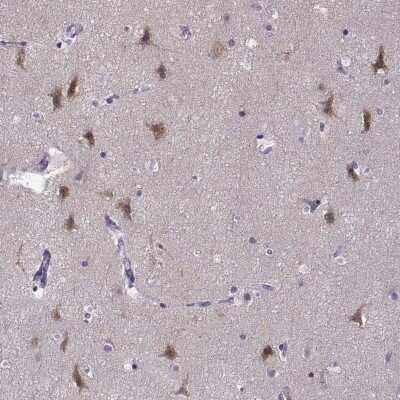 Immunohistochemistry-Paraffin: LRFN2 Antibody [NBP2-57321]