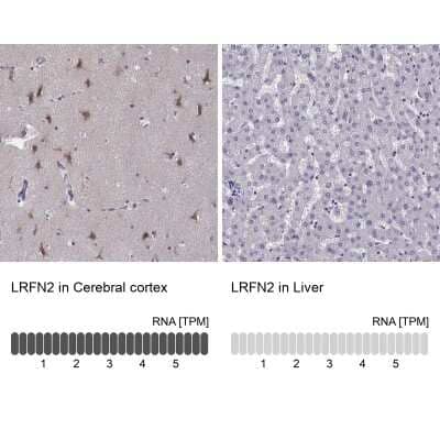 Immunohistochemistry-Paraffin: LRFN2 Antibody [NBP2-57321]
