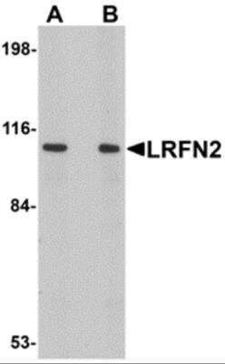 Western Blot: LRFN2 AntibodyBSA Free [NBP2-81731]