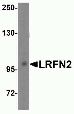 Western Blot: LRFN2 AntibodyBSA Free [NBP2-81731]