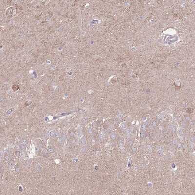 Immunohistochemistry-Paraffin: SALM4/LRFN3 Antibody [NBP2-14199]