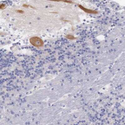 Immunohistochemistry-Paraffin: LRFN5 Antibody [NBP1-88412]