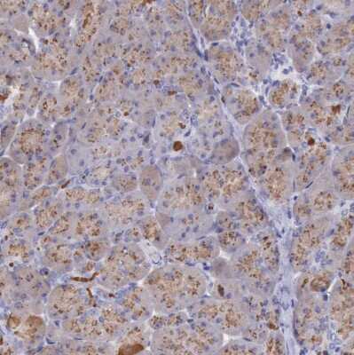 Immunohistochemistry-Paraffin: LRFN5 Antibody [NBP1-88412]