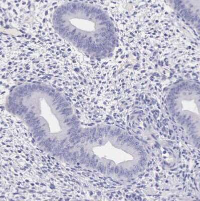 Immunohistochemistry-Paraffin: LRFN5 Antibody [NBP1-88412]
