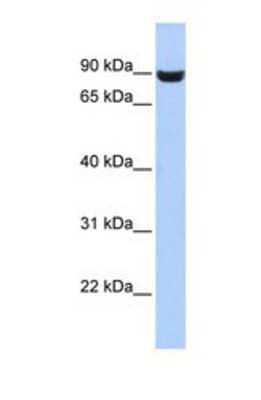 Western Blot: LRFN5 Antibody [NBP1-69704]