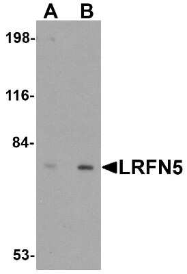 Western Blot: LRFN5 AntibodyBSA Free [NBP1-77004]