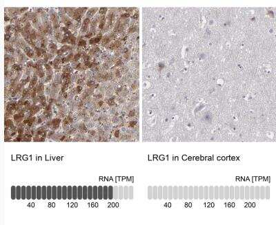 Immunohistochemistry-Paraffin: LRG1 Antibody [NBP1-82823]