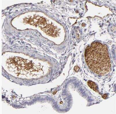 Immunohistochemistry-Paraffin: LRG1 Antibody [NBP1-82823]