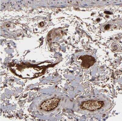 Immunohistochemistry-Paraffin: LRG1 Antibody [NBP1-82823]