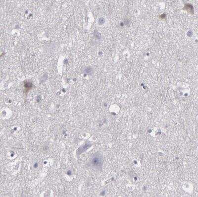 Immunohistochemistry-Paraffin: LRG1 Antibody [NBP1-82823]