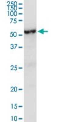 Western Blot: LRG1 Antibody [H00116844-D01P]