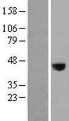 Western Blot: LRG1 Overexpression Lysate [NBL1-12665]