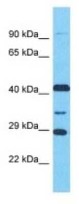 Western Blot: LRGUK Antibody [NBP3-09935]