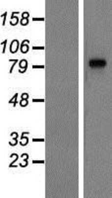 Western Blot: LRGUK Overexpression Lysate [NBP2-05539]