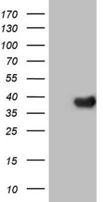 Western Blot: LRH-1/NR5A2 Antibody (OTI3H8) [NBP2-46248]