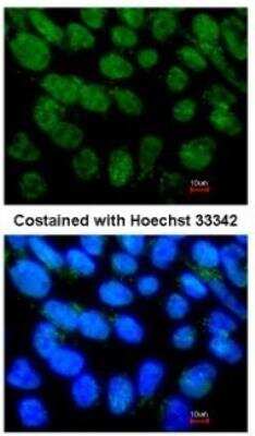 Immunocytochemistry/ Immunofluorescence: LRH-1/NR5A2 Antibody [NBP1-32489]