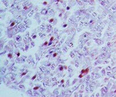 Immunohistochemistry-Paraffin: LRH-1/NR5A2 Antibody [NBP2-27196]