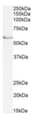 Western Blot: LRH-1/NR5A2 Antibody [NBP2-42513]