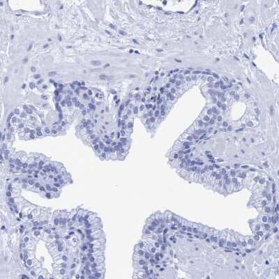 Immunohistochemistry-Paraffin: INSL6 Antibody [NBP1-80834]