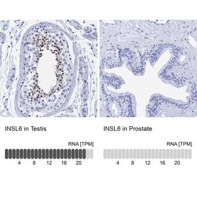 Immunohistochemistry-Paraffin: INSL6 Antibody [NBP1-80834]