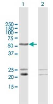 Western Blot: LRIF1 Antibody [H00055791-B01P]