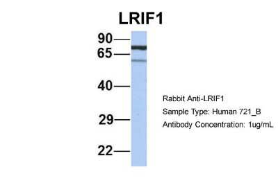 Western Blot: LRIF1 Antibody [NBP1-56659]