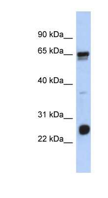 Western Blot: LRIF1 Antibody [NBP1-56819]