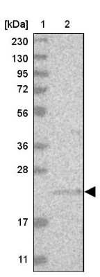 Western Blot: INSL6 Antibody [NBP1-80834]