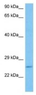 Western Blot: LRIF1 Antibody [NBP3-10062]