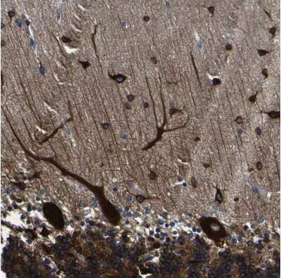 Immunohistochemistry-Paraffin: LRIG1 Antibody [NBP2-30926]