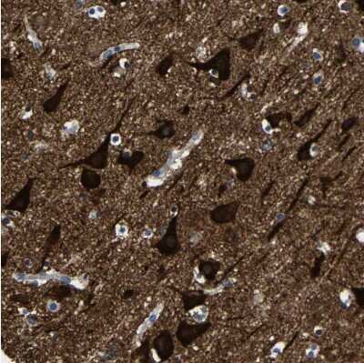 Immunohistochemistry-Paraffin: LRIG1 Antibody [NBP2-30926]