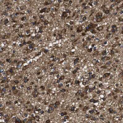 Immunohistochemistry-Paraffin: LRIG1 Antibody [NBP2-30926]