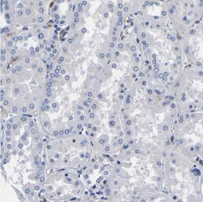Immunohistochemistry-Paraffin: LRIG1 Antibody [NBP2-30926]