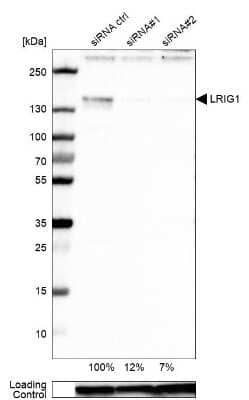 Western Blot: LRIG1 Antibody [NBP2-30926]