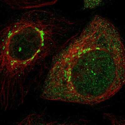 Immunocytochemistry/ Immunofluorescence: LRIG2 Antibody [NBP1-93621]