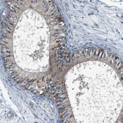 Immunohistochemistry-Paraffin: LRIG2 Antibody [NBP1-93621]