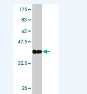 Western Blot: LRIG3 Antibody (4D5) [H00121227-M02]