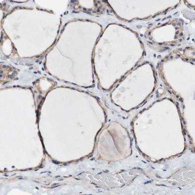 Immunohistochemistry-Paraffin: LRIG3 Antibody [NBP1-81877]