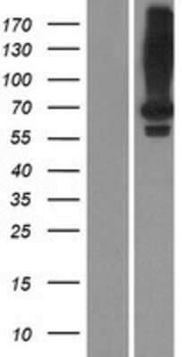 Western Blot: LRIT2 Overexpression Lysate [NBP2-08679]