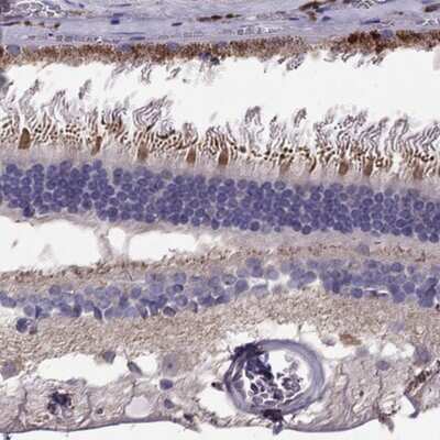 Immunohistochemistry-Paraffin: LRIT3 Antibody [NBP1-83895]