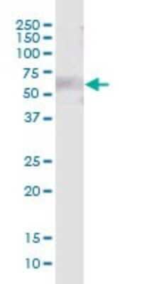 Western Blot: LRIT3 Antibody [H00345193-B01P]