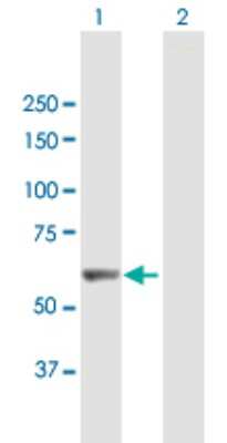 Western Blot: LRIT3 Antibody [H00345193-B01P]