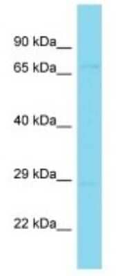 Western Blot: LRIT3 Antibody [NBP3-09749]