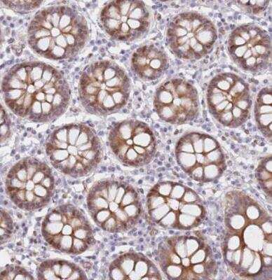 Immunohistochemistry-Paraffin: LRMDA Antibody [NBP2-14802]