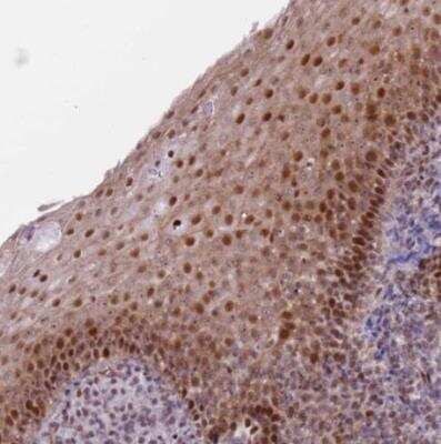 Immunohistochemistry-Paraffin: LRMDA Antibody [NBP2-14802]