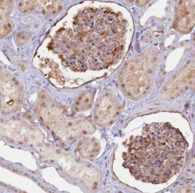 Immunohistochemistry-Paraffin: LRMDA Antibody [NBP2-14802]