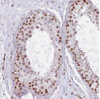 Immunohistochemistry-Paraffin: LRMDA Antibody [NBP2-14802]